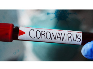 20200309-coronavirus